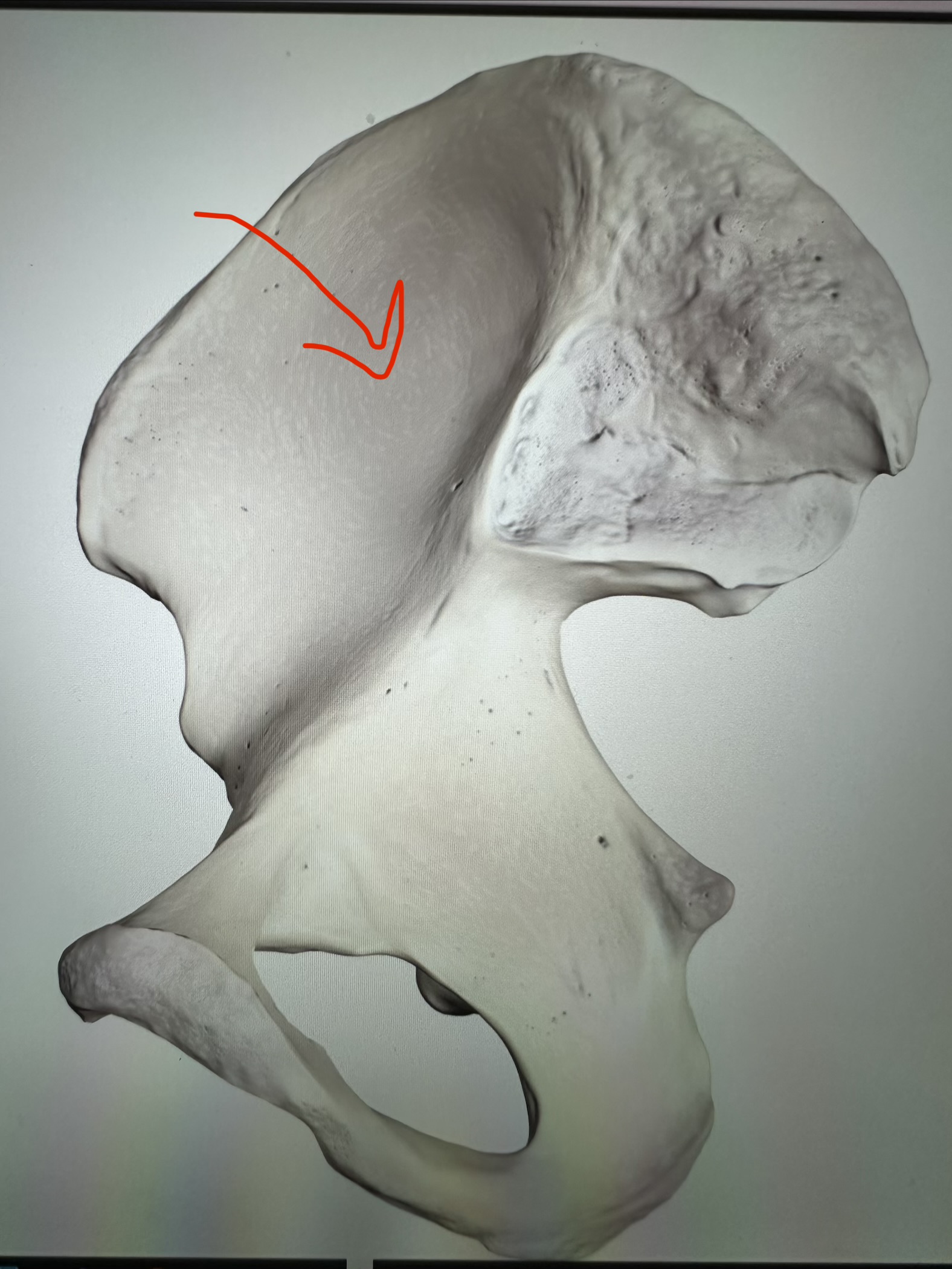 <p>os coxae, smooth hollow on iliac blade</p>