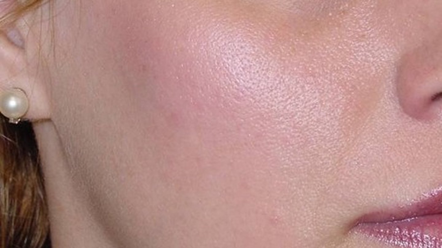 <p>cheek</p>