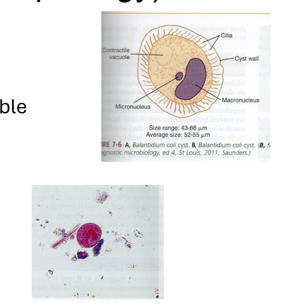 <p>What are morphology features of Balantidium coli cysts?</p>