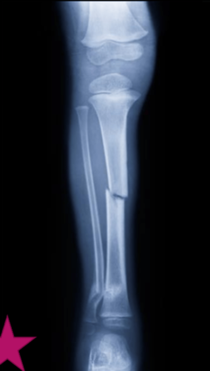 <p>Identify</p>