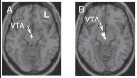 <p>Describe figure 2</p>