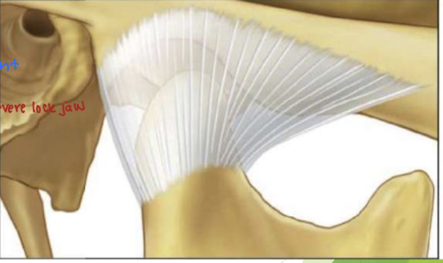 <p>puncturing the capsular ligament leads to friction between the condyle and posterior border of the disk</p><p>-this can eventually lead to arthritis and lock jaw</p><p>the capsular ligament retains synovial fluid</p>