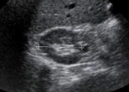 <p>More of the liver is shown in this image so it is the ________ kidney</p>