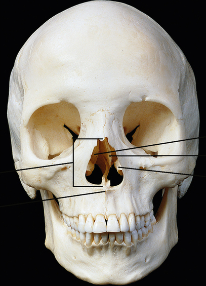 <p>Name the middle part of the nose</p>