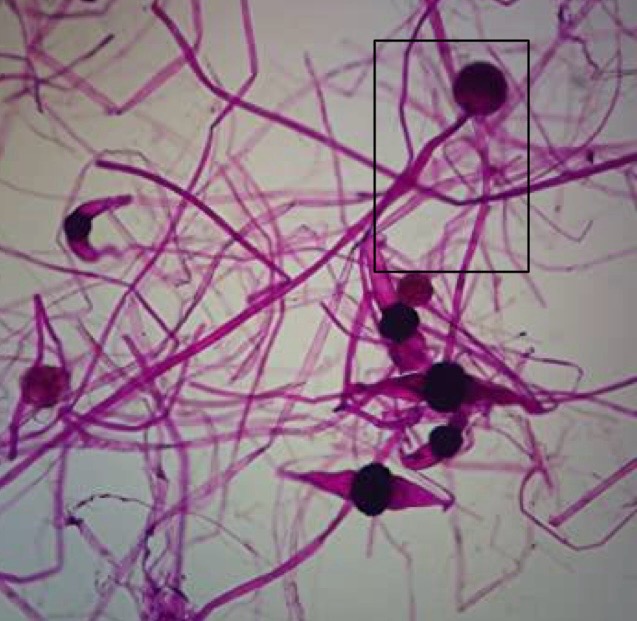 <p>Identify: Fungi</p>