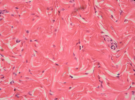 <p>dense irregular fibrous connective tissue</p>