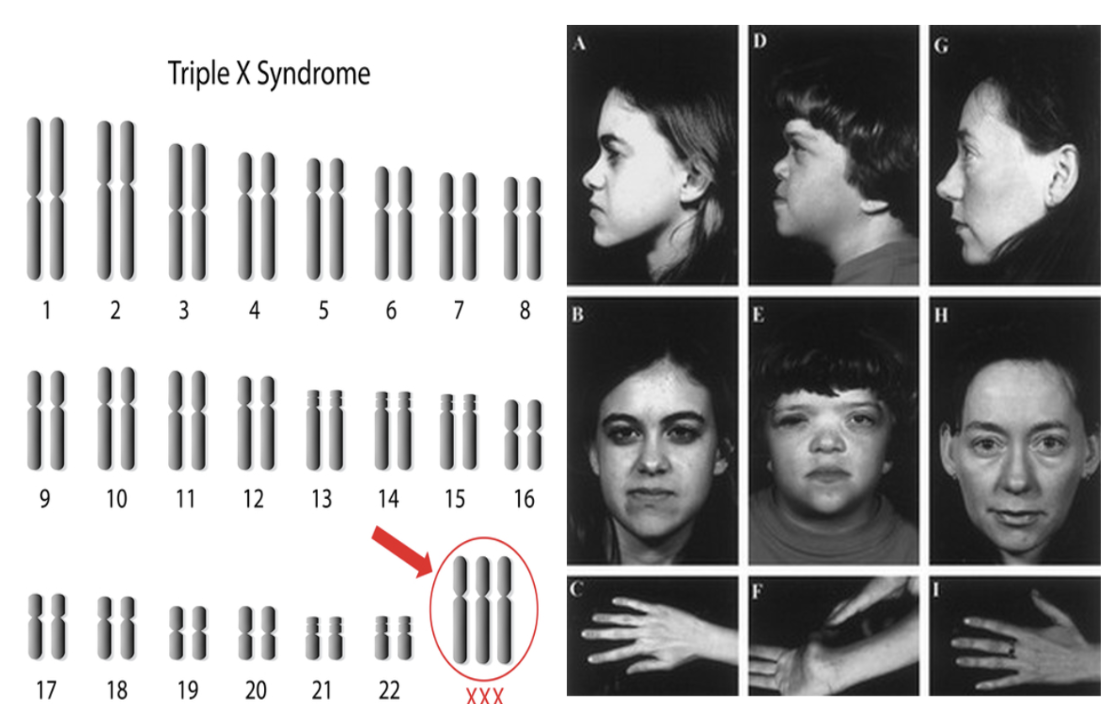 <p>Triplo X (XXX)</p>