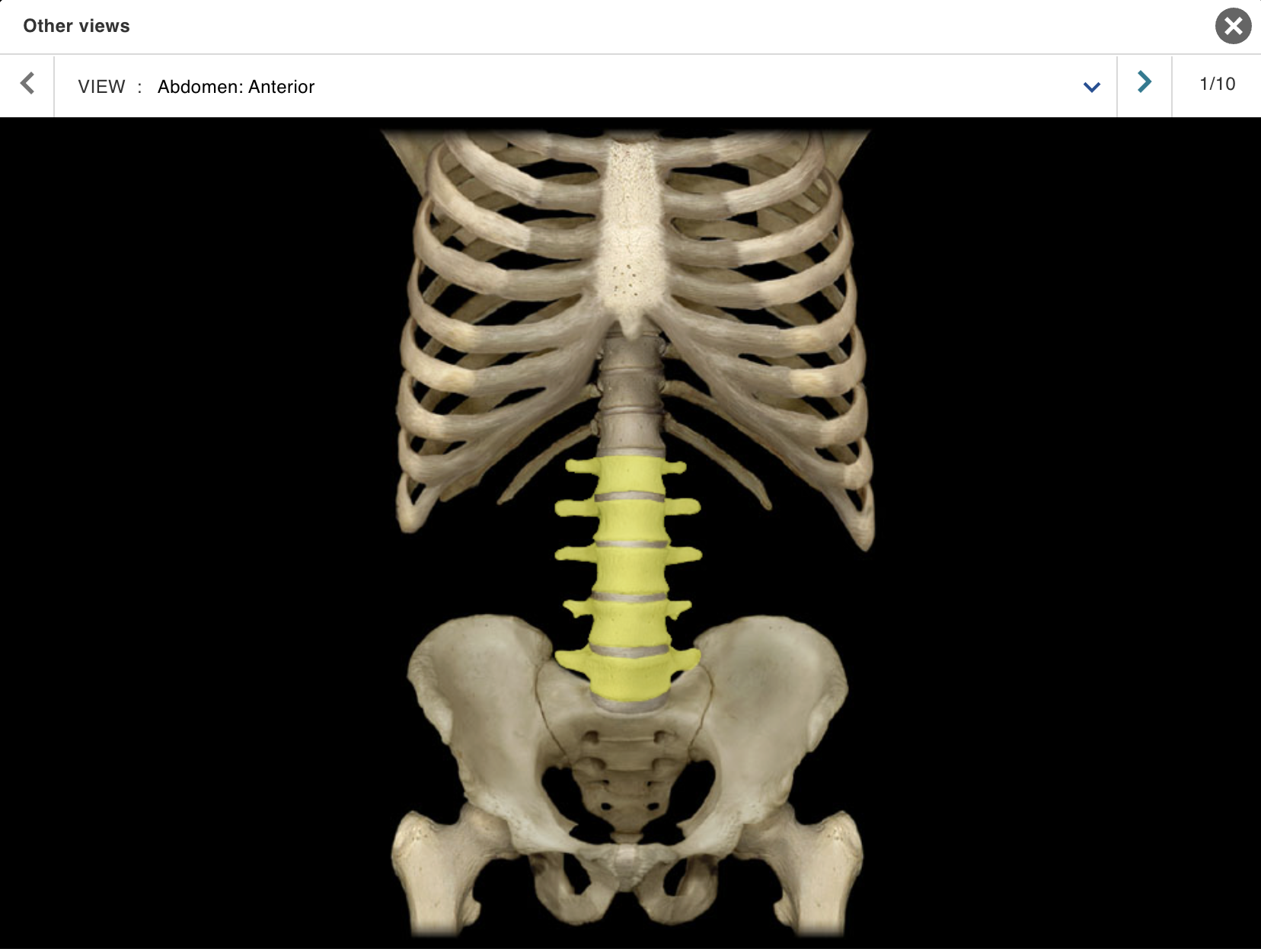 <p>Location:</p><ul><li><p>﻿﻿Lower back</p></li><li><p>﻿﻿Between T12 and S1 vertebrae</p></li></ul><p class="p1">Description:</p><ul><li><p>﻿﻿Five individual vertebrae</p></li><li><p>﻿﻿Characteristic features include large size, kidney bean-shaped body, and a thick, blunt spinous process</p></li></ul><p>Comment:</p><ul><li><p>﻿﻿Bodies arranged to form prominent anterior convexity (lumbar curvature; also known as lumbar lordosis, which can be accentuated pathologically)</p></li><li><p>﻿﻿Intervertebral discs between lumbar vertebrae most commonly herniate ("slipped-disk")</p></li></ul><p></p>