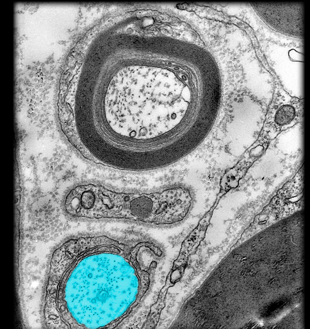 <h4 collapsed="false" seolevelmigrated="true"><strong>Location:</strong></h4><ul><li><p>Central nervous system (CNS)</p></li><li><p>Peripheral nervous system (PNS)</p></li></ul><h4 collapsed="false" seolevelmigrated="true"><strong>Description:</strong></h4><ul><li><p>Axons lacking a myelin sheath</p></li><li><p>Unmyelinated axons rest in invaginations of Schwann cell or oligodendrocyte</p></li></ul><h4 collapsed="false" seolevelmigrated="true"><strong>Function:</strong></h4><ul><li><p>Conducts nerve impulses</p></li></ul><h4 collapsed="false" seolevelmigrated="true"><strong>Comment:</strong></h4><ul><li><p>Nerve impulses travel slower in unmyelinated axons (0.5-2.0 m/sec) than in small, myelinated axons of similar size (3-15 m/sec)</p></li><li><p>Myelinating cell is oligodendrocyte (CNS) or Schwann cell (PNS)</p></li></ul>