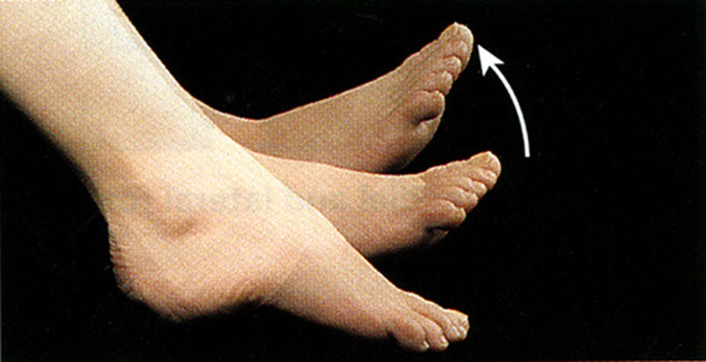 <p>Lifting the foot (toes facing upwards)</p>