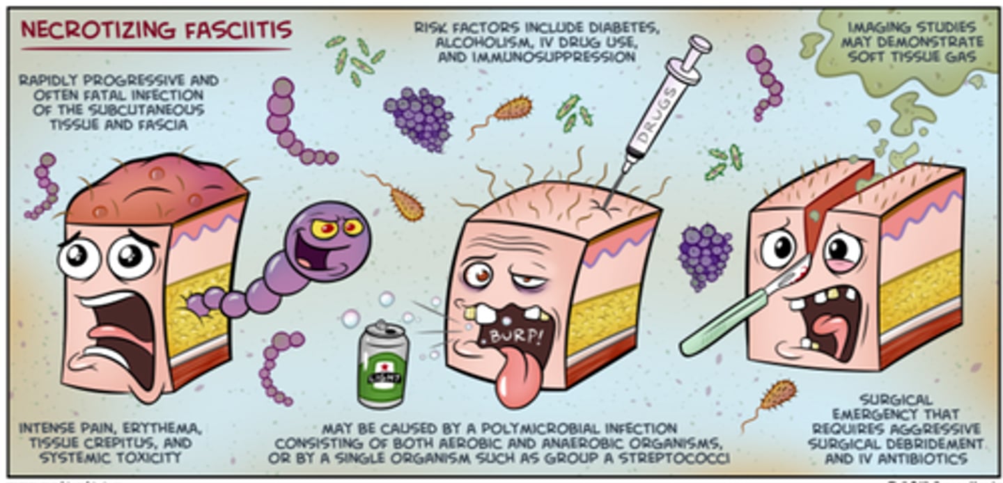 <p>Pathogen: Streptococcus pyogenes (“flesh-eating” strain)</p><p>S+S: Red, warm, blistered skin, swelling, severe pain</p><p>Transmission: Bacteria enter through skin cuts</p><p>treatment: requiring surgery removing dead, damaged tissue (debridement)</p>