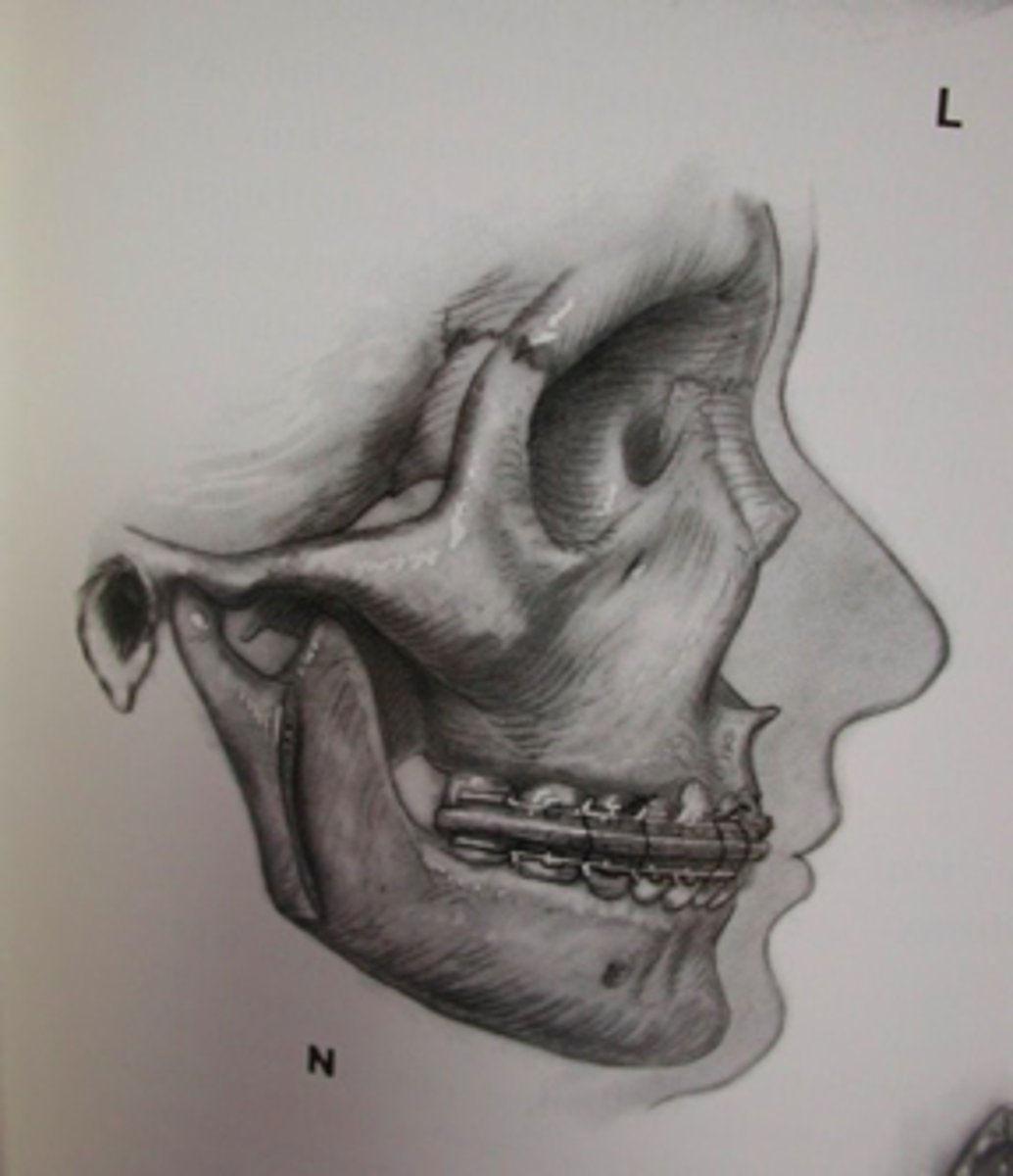 <p>ID the procedure:</p>