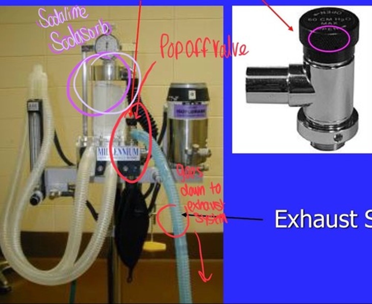 <p>-always keep it open or you will explode patient!</p>