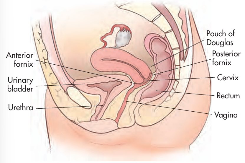 <p>Rectouterine pouch is AKA?</p>
