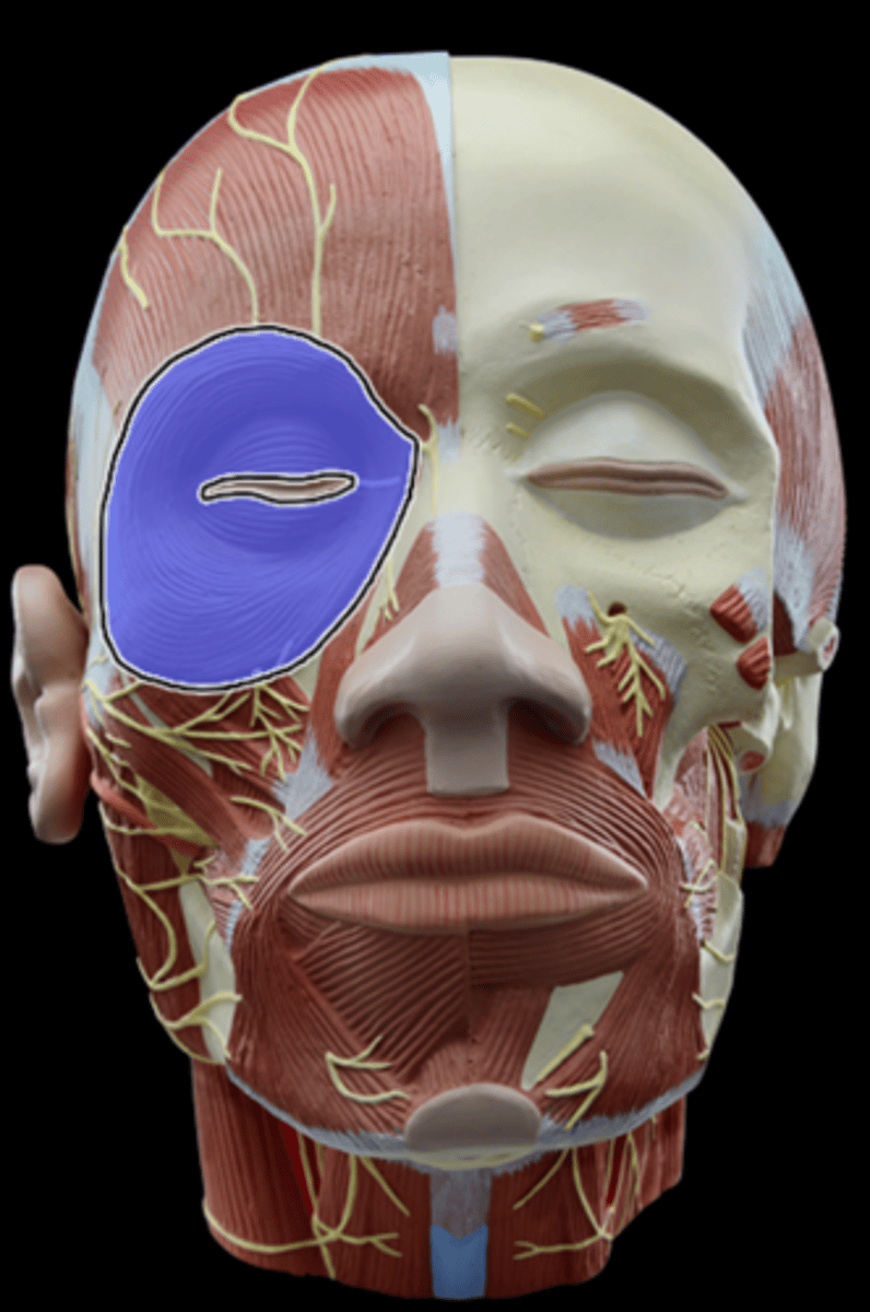 <p>What Muscle Is Highlighted?</p>