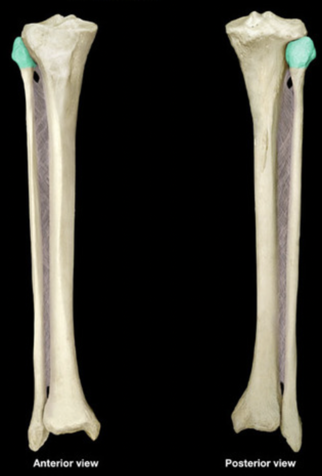 <p>Head of fibula</p>