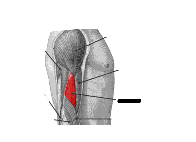 <p>(black)</p>