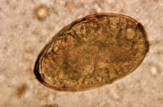 <p>A- what is the method of examination used here</p><p>B-how to use it</p><p>C- What is the name of organism in</p>