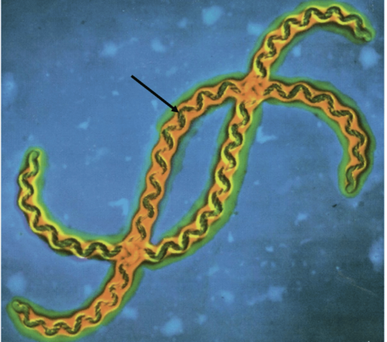 <p>Leptospira - spirochete bacterium</p>