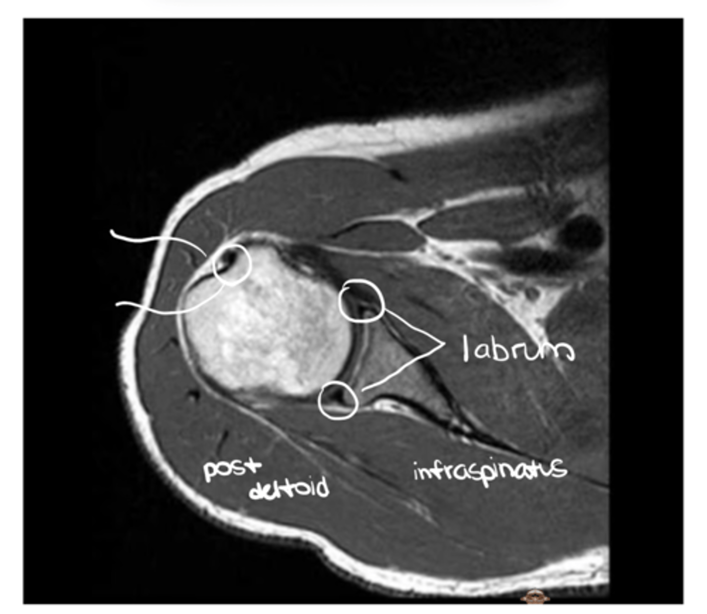 <p>What has been circled and what has been pointed to in this image?</p>