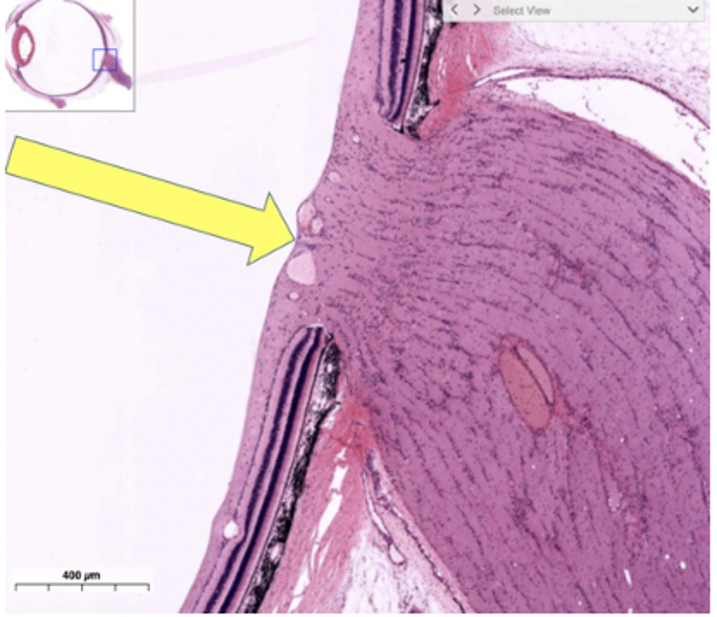 <p>Identify the transitional region</p>