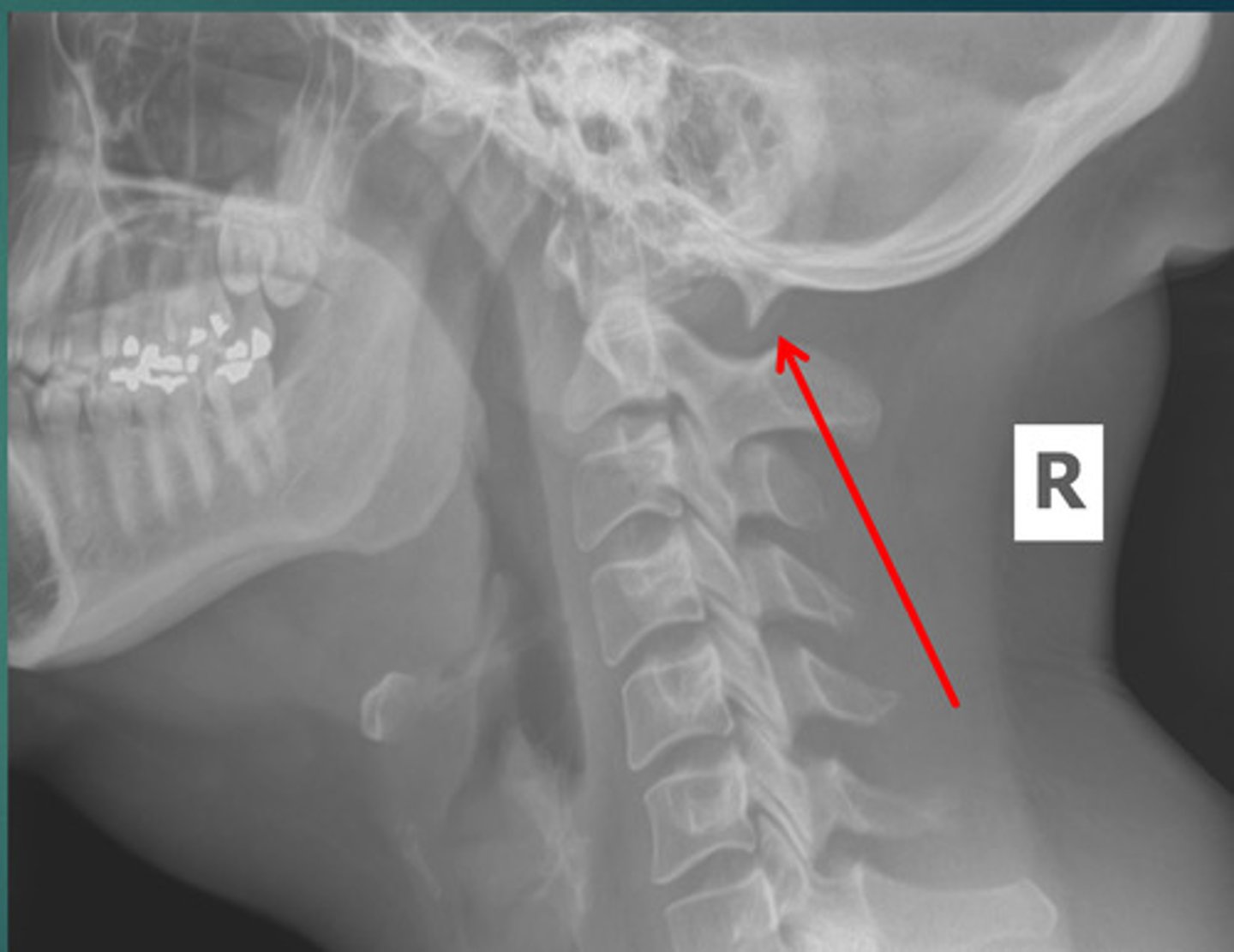 <p>What anomaly is this?</p>