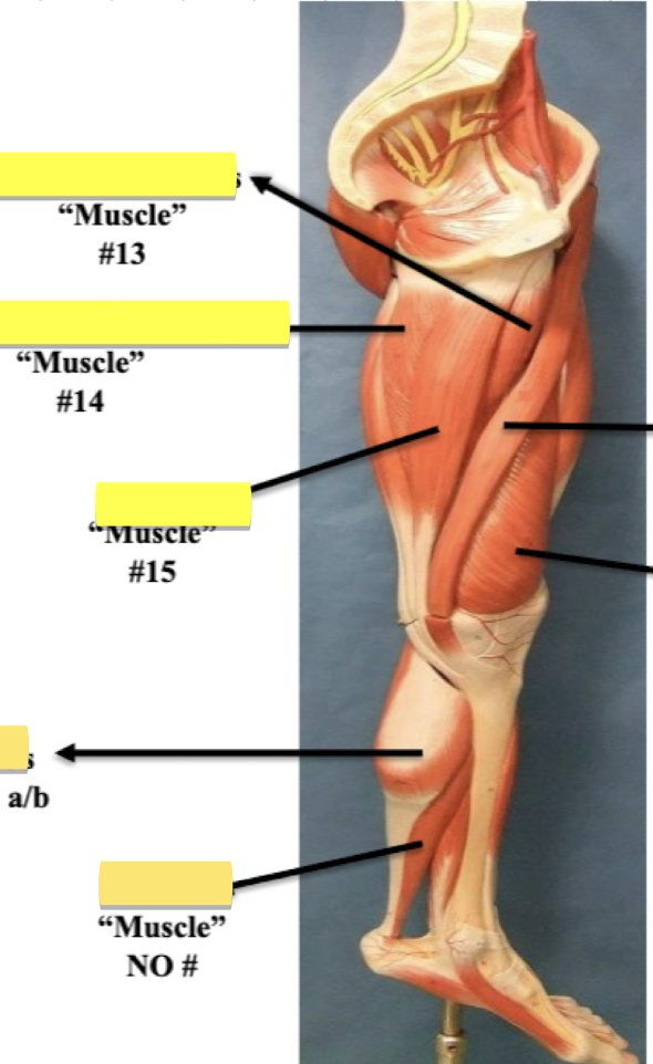 <p>Label muscle #15 </p>