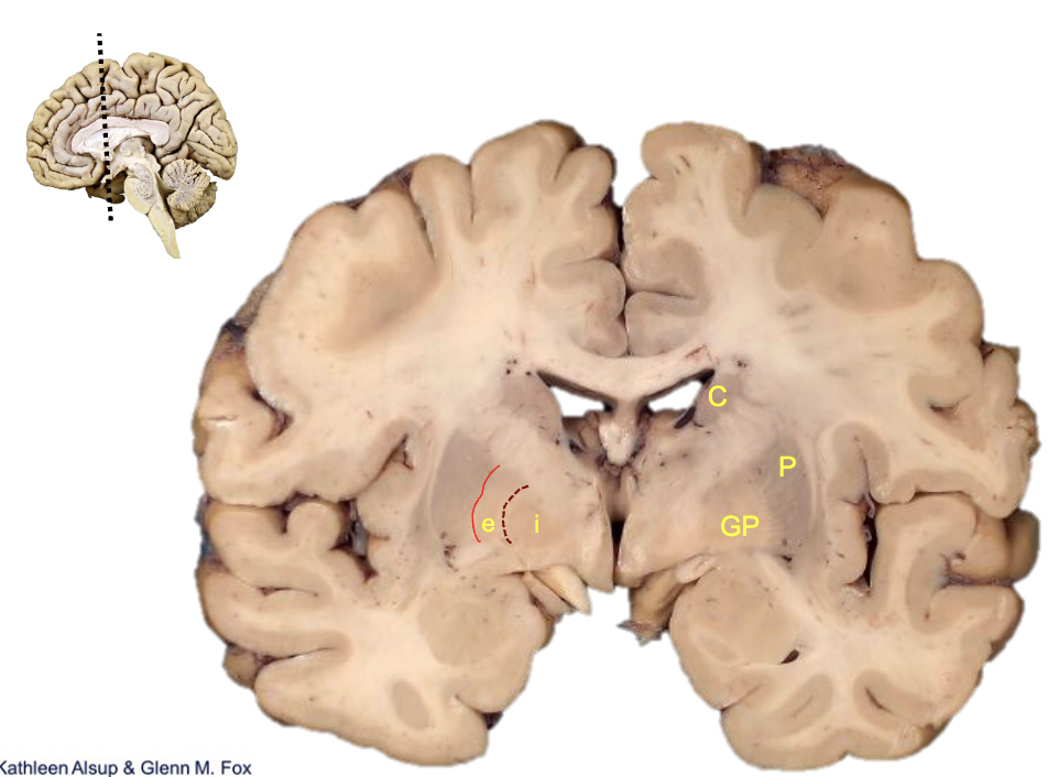 <p><strong>what is i?</strong></p>