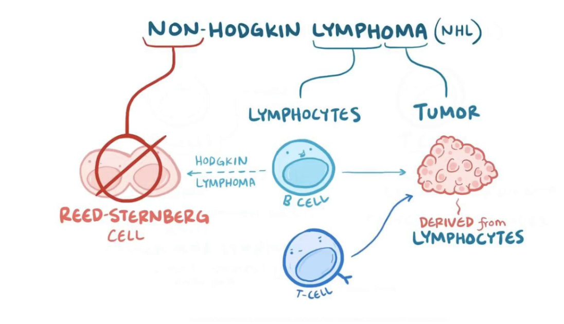 <p>Lymfom brukar delas upp i följande:</p><ul><li><p><strong>Non Hodgkins</strong>: Står för 90% av alla lymfom. Det finns olika typer av NHL som kan drabba B- eller T-celler. </p></li><li><p><strong>Hodgkins</strong>: Högmalignt lymfom med B-cellsursprung. Karaktäristiskt är Reed-Sternberg-celler. </p></li></ul>