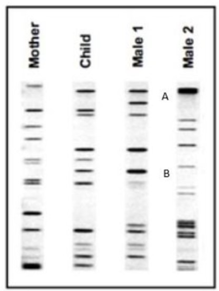 <p>A DNA "picture" features…</p>