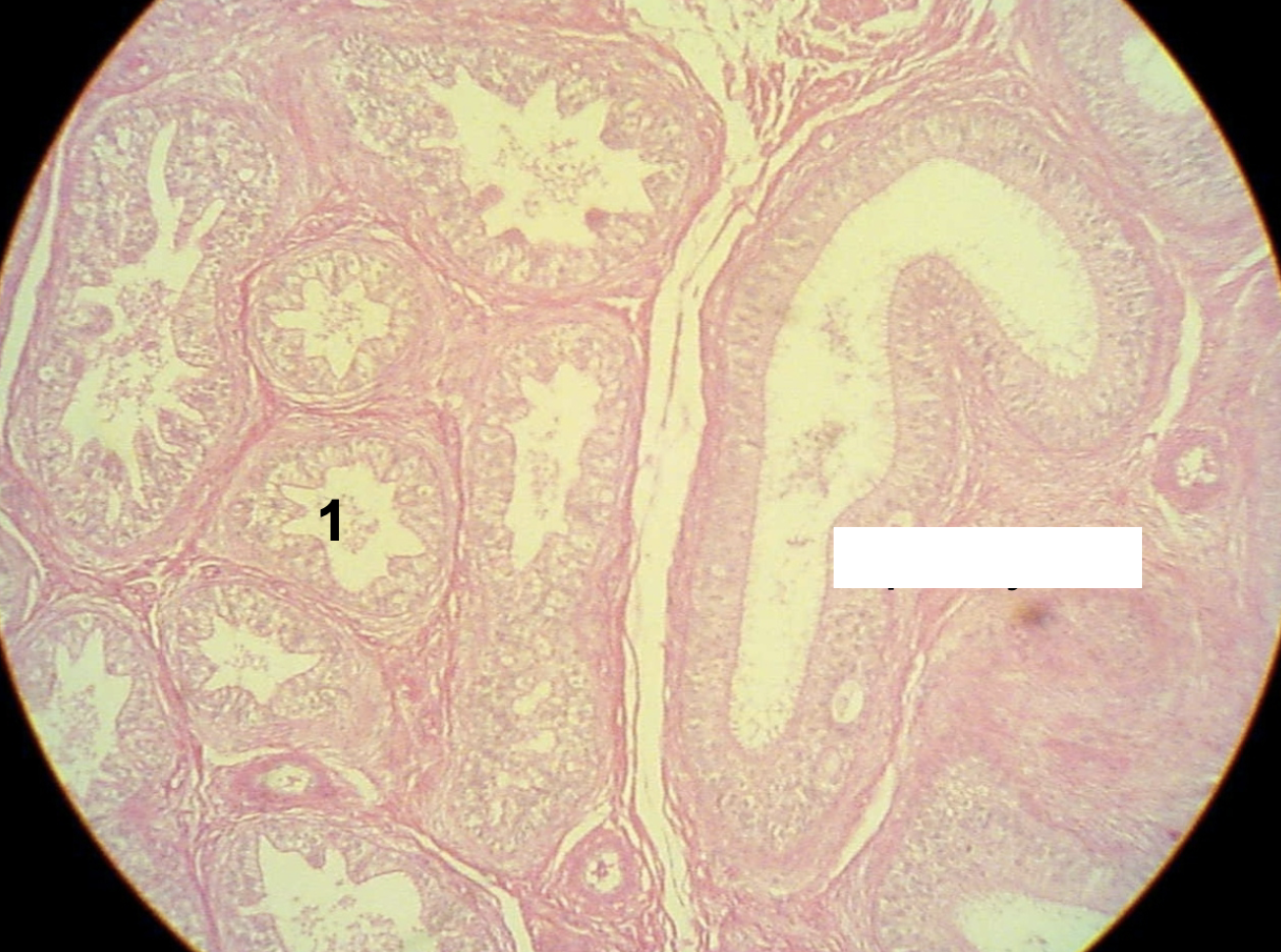 <p>What is the larger opening that is being indicated by the white box?</p>