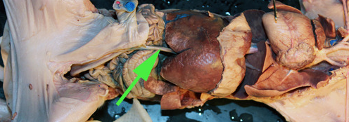<p><span>The vein marked by the green arrow is the </span><strong>umbilical vein</strong></p>