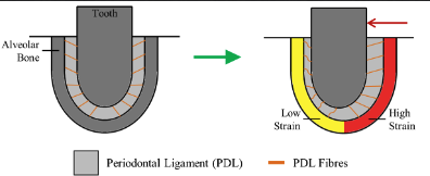 <ul><li><p>low PDL fiber strain → bone resorption </p></li><li><p>high PDL fiber strain → bone formation </p></li></ul><p></p>