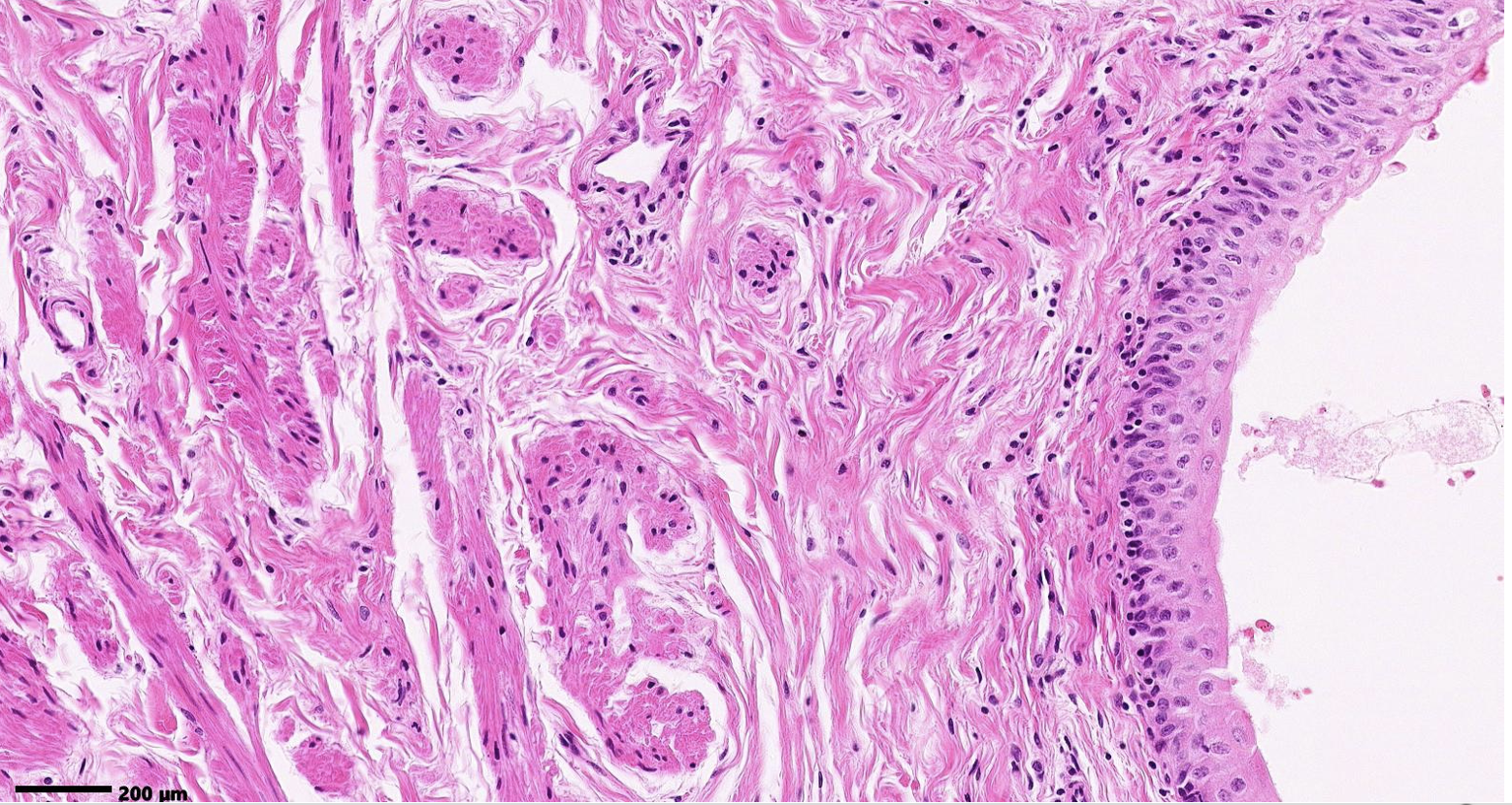 <p>What tissue is shown? bonus point if you know where it is</p>