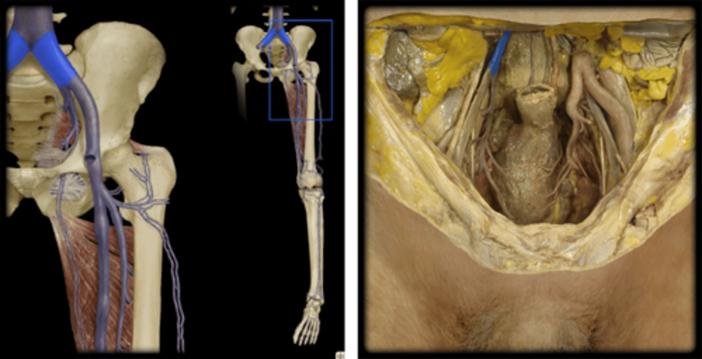 <p>Name these vessels.</p>