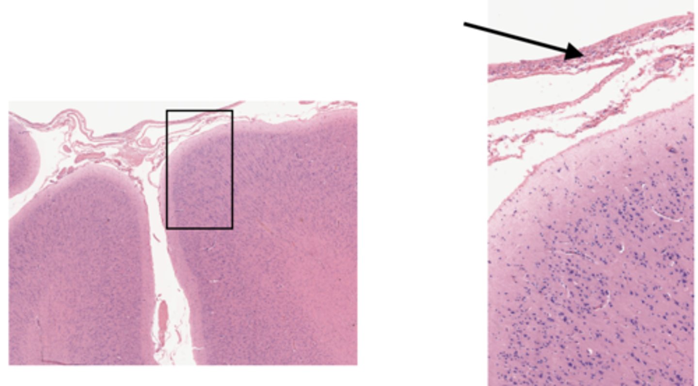<p>Identify the layer of the cerebrum</p>