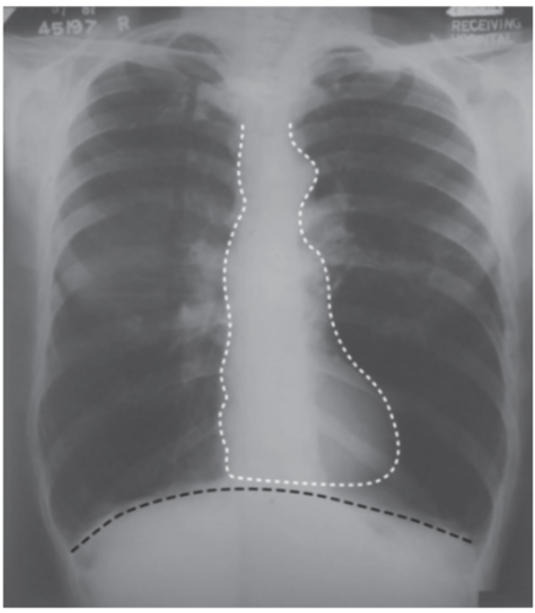 <p>What pathology is this?</p>