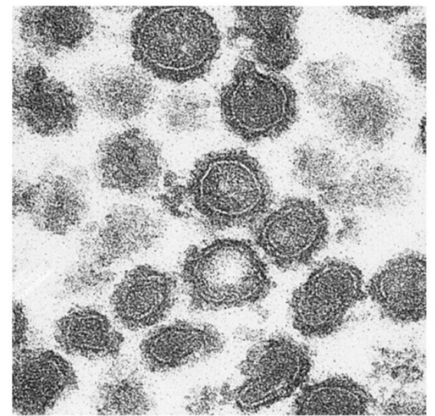 <ul><li><p>Normally, coated vesicles are hard to capture because the stage is very brief</p></li><li><p>To <strong>freeze this step</strong>, prevent <strong>uncoating</strong> by:</p><ul><li><p>Using a <strong>non-hydrolyzable GTP</strong> (keeps Sar1 in active GTP-bound form)</p></li><li><p>Using a <strong>Sar1 mutant</strong> with impaired GTPase activity</p></li></ul></li><li><p>Result: Sar1-GTP remains bound, so the coat <strong>stays on</strong> the vesicle</p><ul><li><p>This prevents vesicle transport, docking at target membrane and cargo unloading since coat proteins block necessary surface proteins needed for these steps</p></li></ul></li><li><p>Allows coated vesicles to <strong>accumulate</strong> and be visualized under <strong>TEM</strong> (black dots = coat proteins)</p></li></ul><p></p>