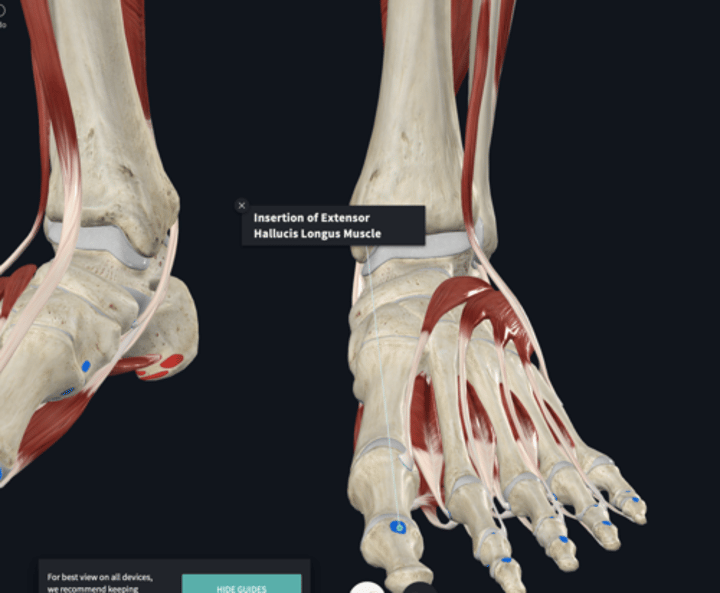 <p>Insertion: extensor hallucis longus</p>