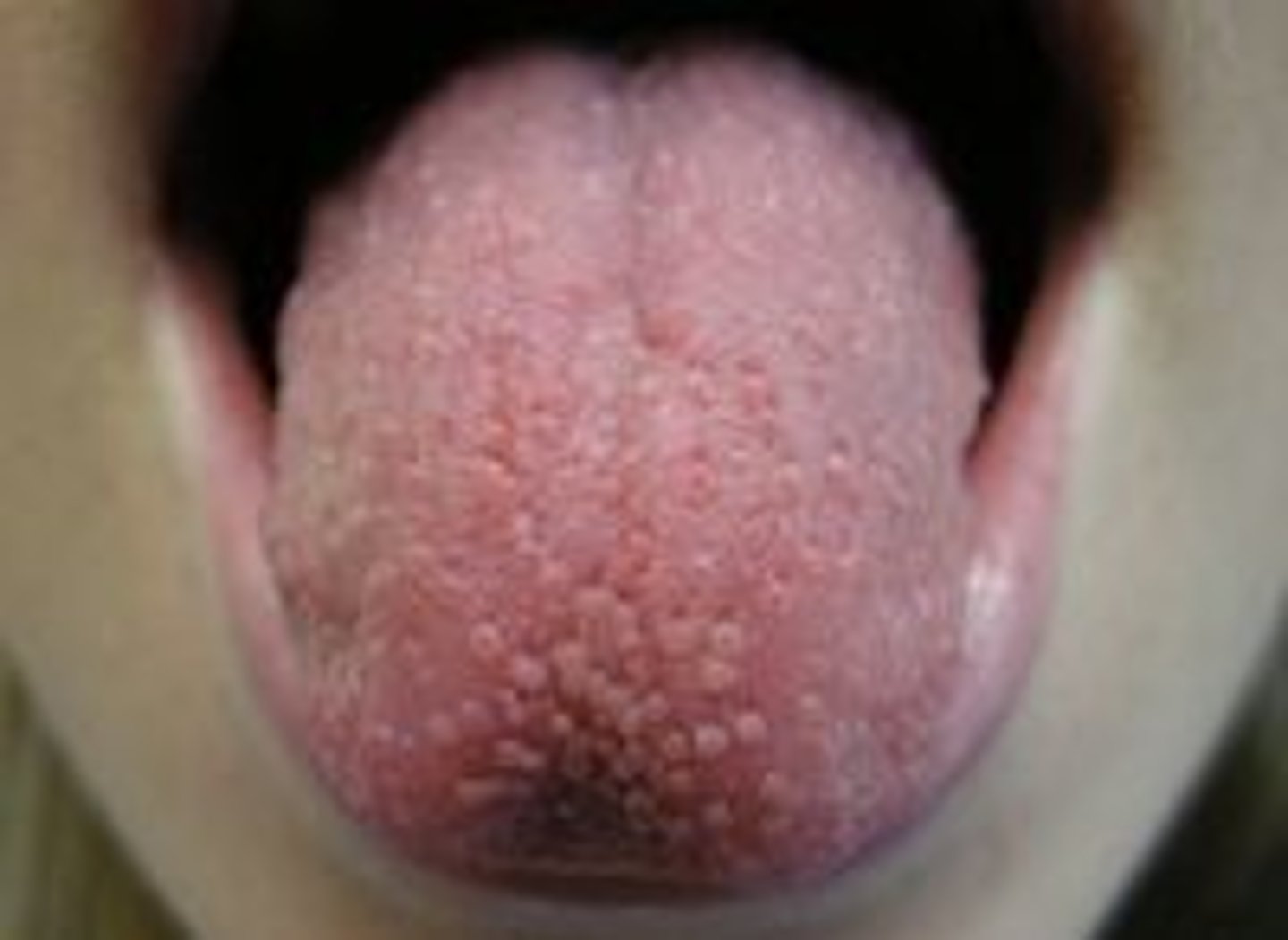 <p>Tiny bumps on the surface of the tongue covered in taste buds</p>