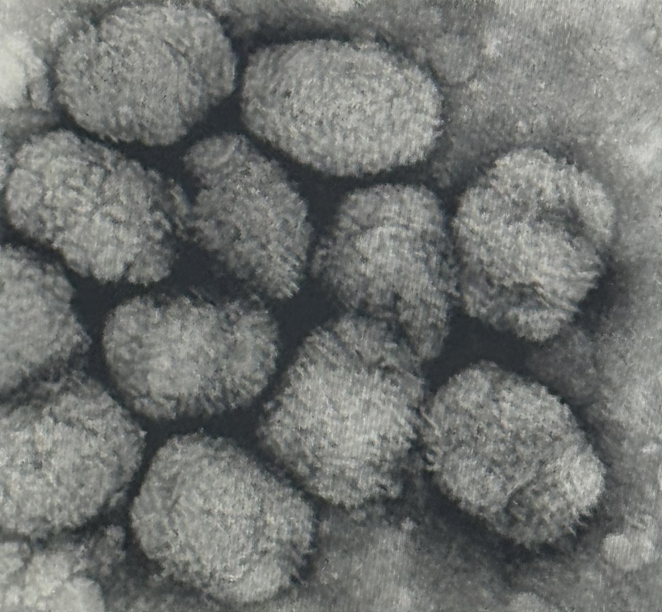 <p>Viren Kurzsteckbriefe Pockenviren (Poxviridae):</p>