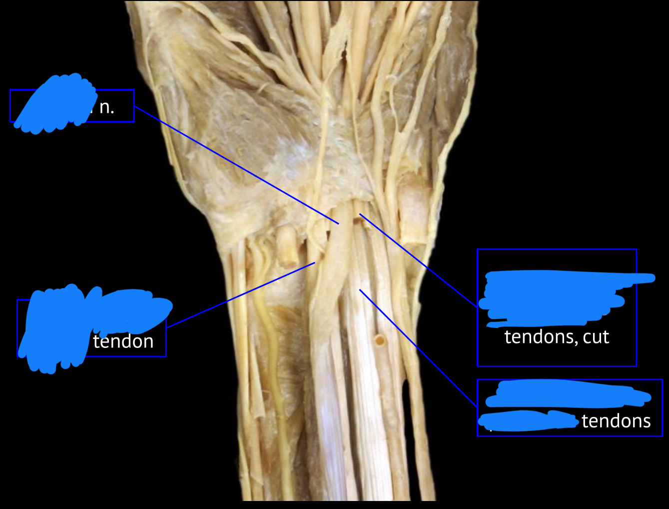 <p>bottom right tendon</p>