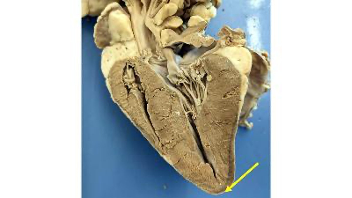 <p>Name the region of the organ</p>