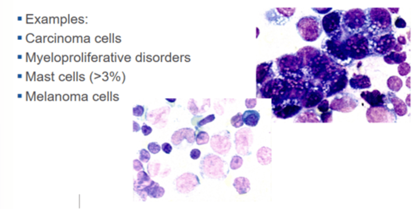 <ul><li><p>Carcinoma cells</p></li><li><p>Myeloproliferative disorders</p></li><li><p>Mast cells (>3%)</p></li><li><p>Melanoma cells</p></li></ul><p></p>