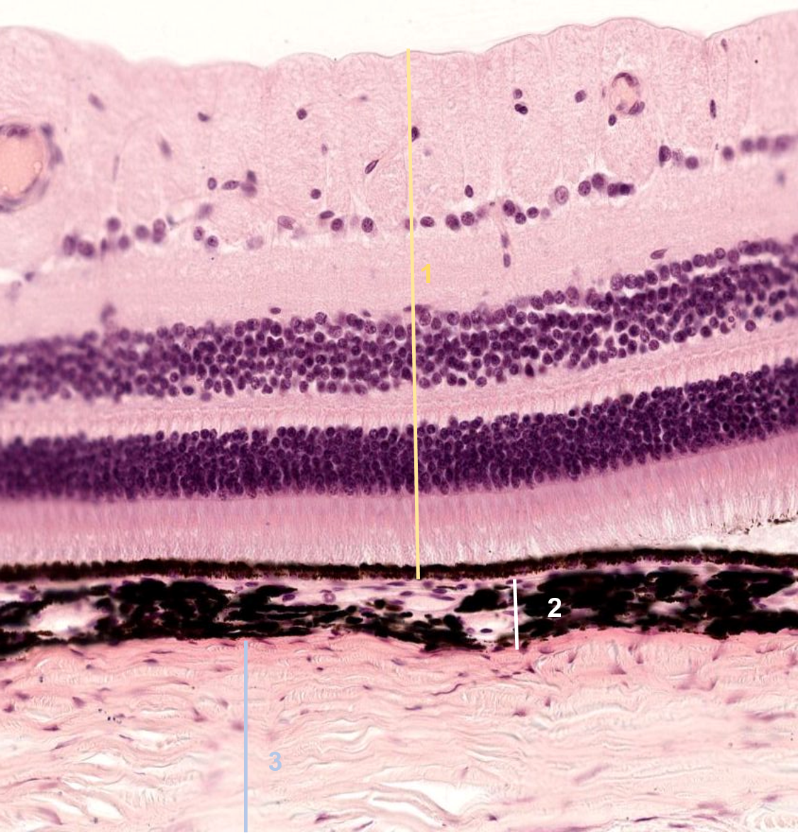 term image