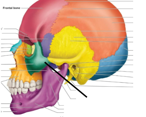 term image
