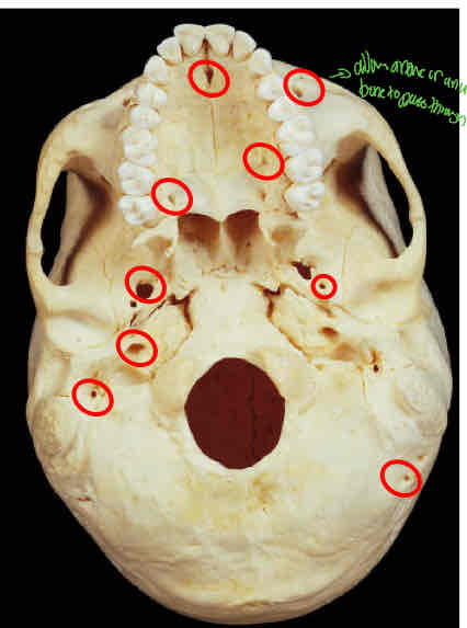 <p>Identify this </p>
