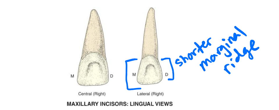 <p>Distal</p><p>This is due to greater slope of incisal edge shorter towards distal, and distal placement of cingulum</p>