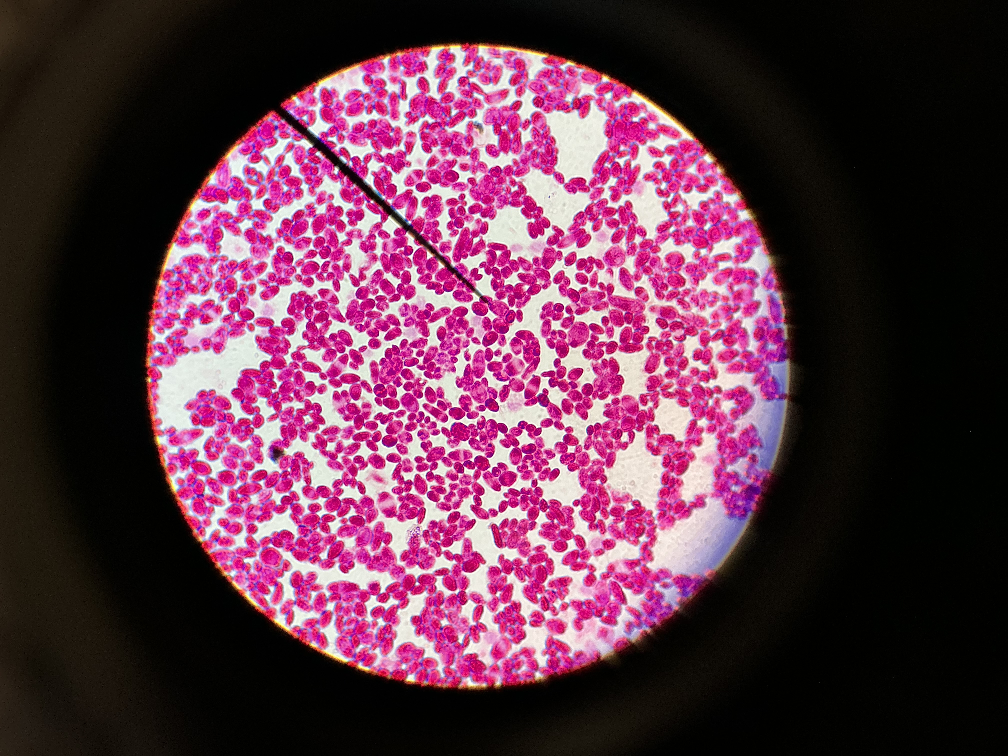 <p>Candida albicans</p>