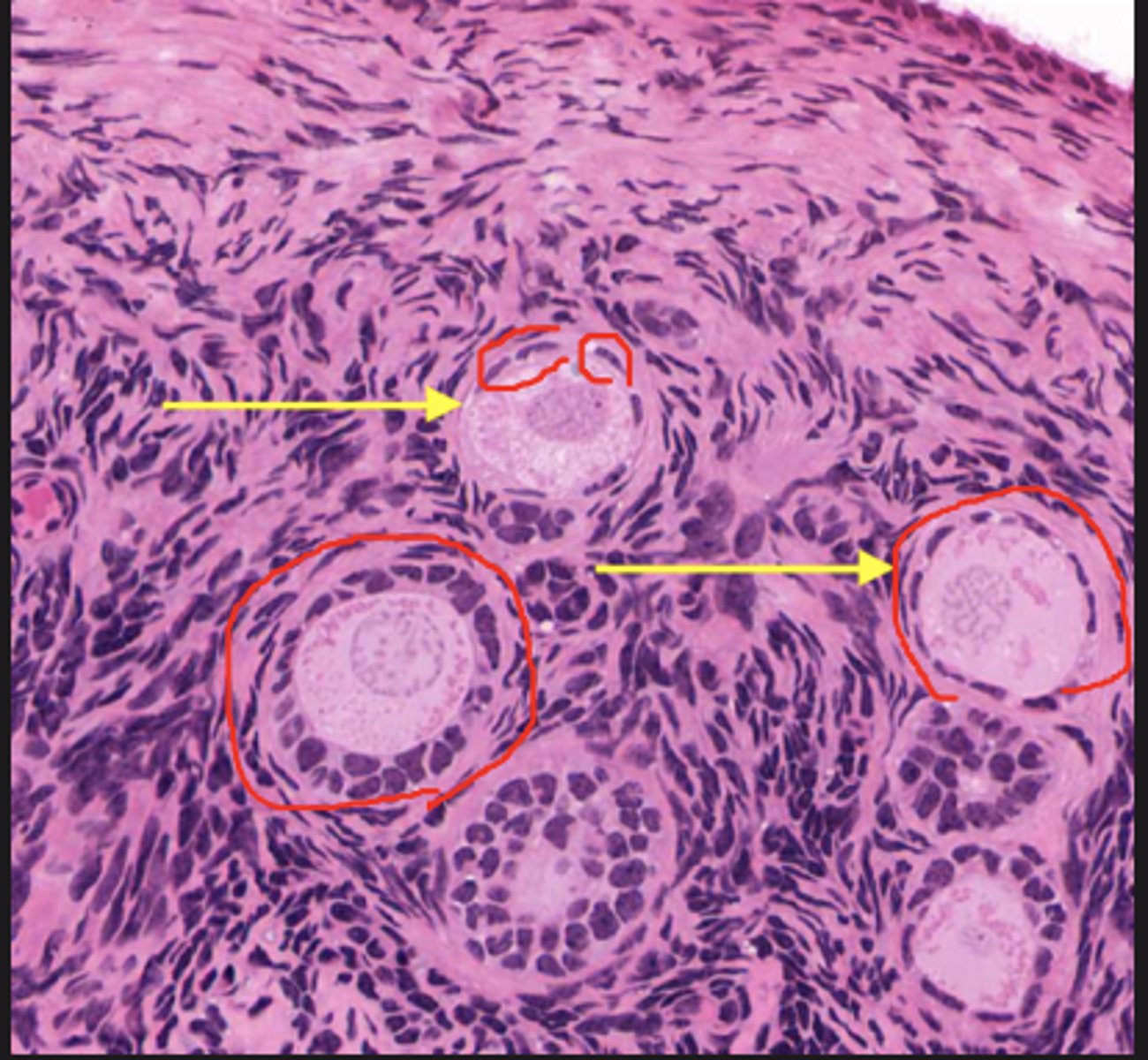 <p>Identify the stage of the follicle</p>